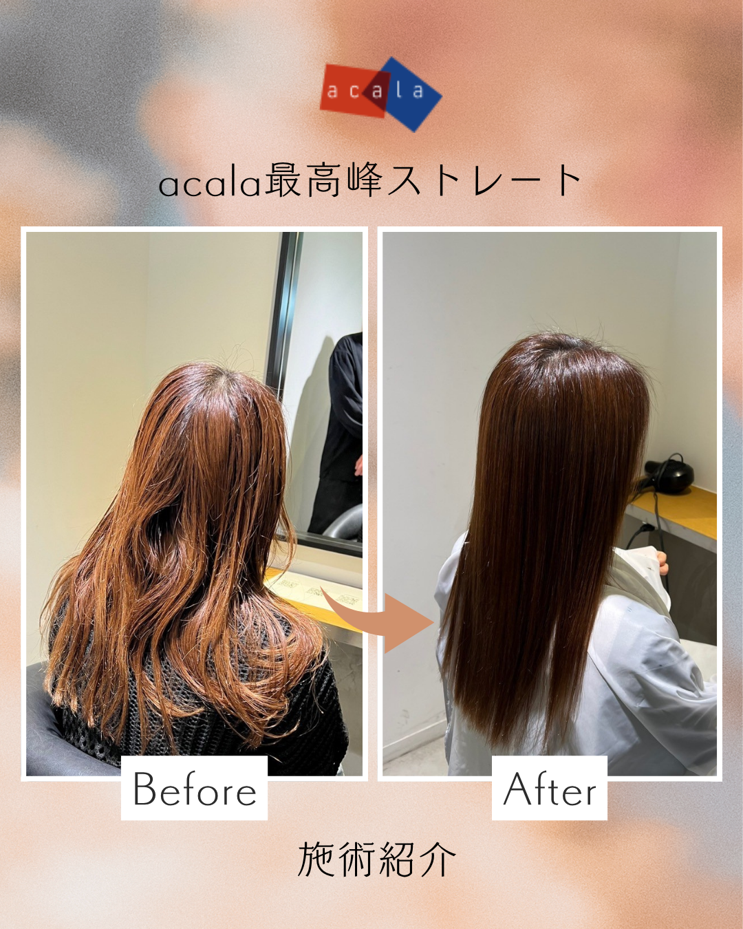 アカラ最高峰ストレート施術紹介、Beforeでうねっている髪が、Afterで見事な輝きのストレートに変わっている写真です。